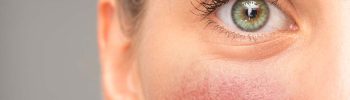 Lupus y Salud Visual