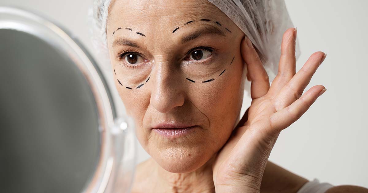 Todo Lo Que Necesitas Saber Sobre La Blefaroplastia Vista 