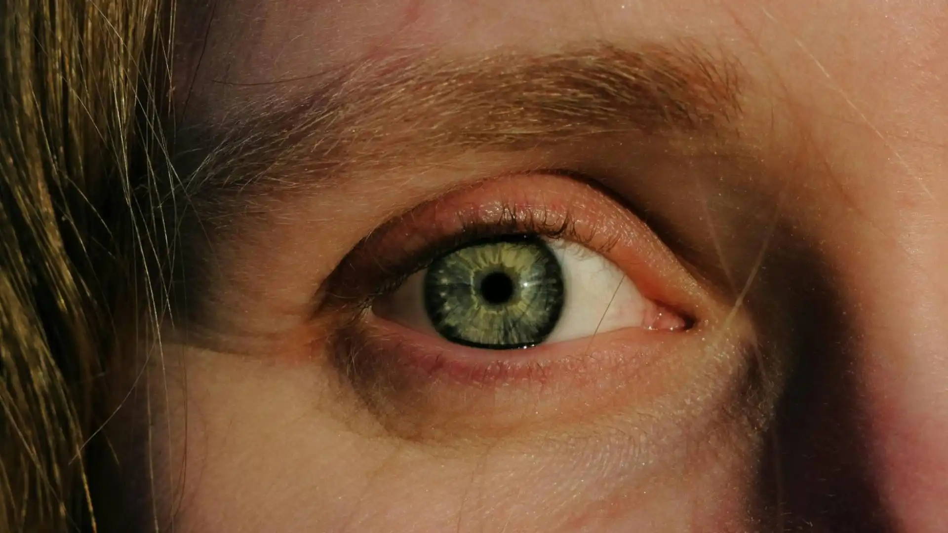 Estados-de-la-retinopatia-diabetica Estados de la retinopatía diabética