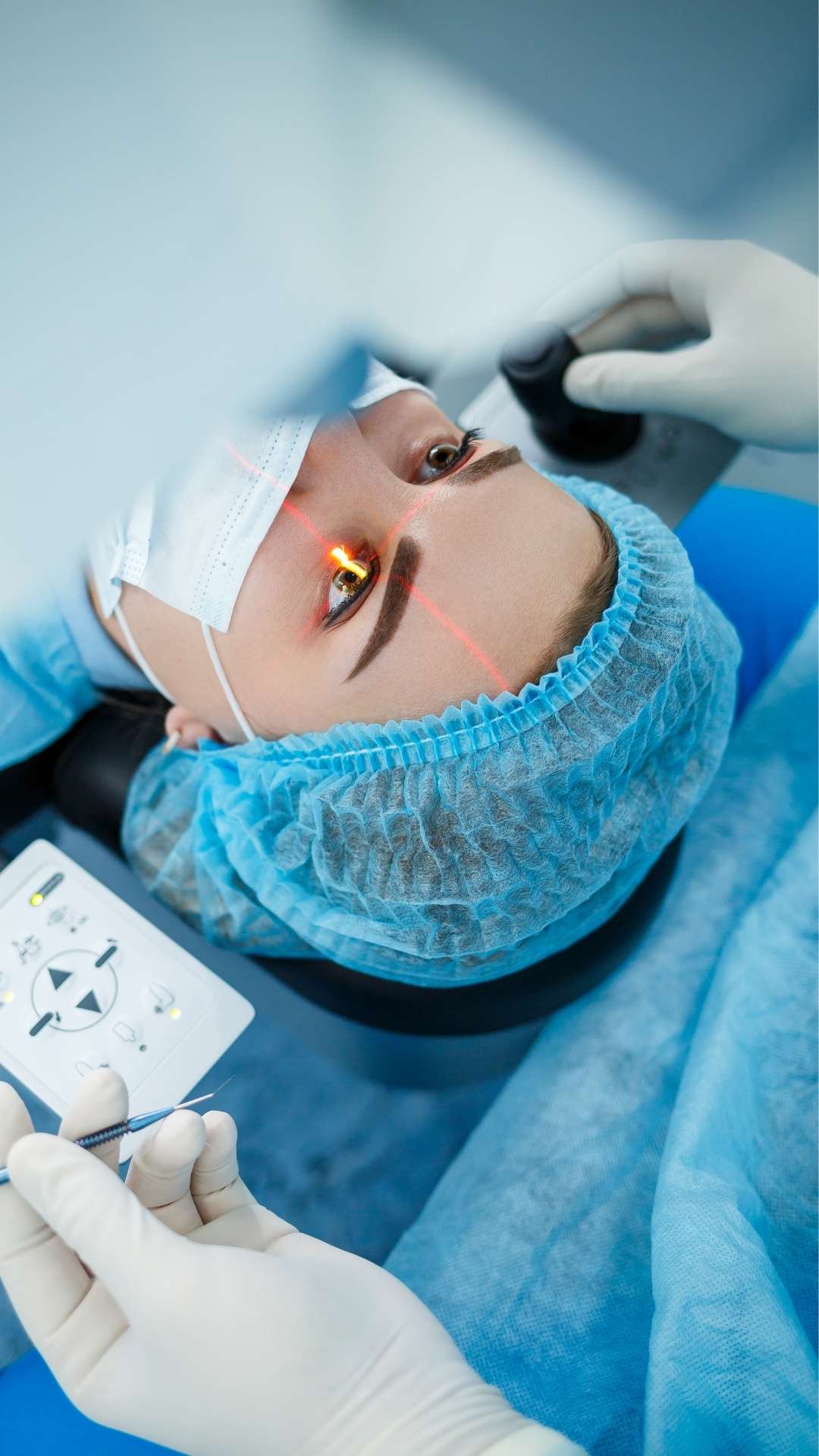 Tratamientos para cataratas Astigmatismo