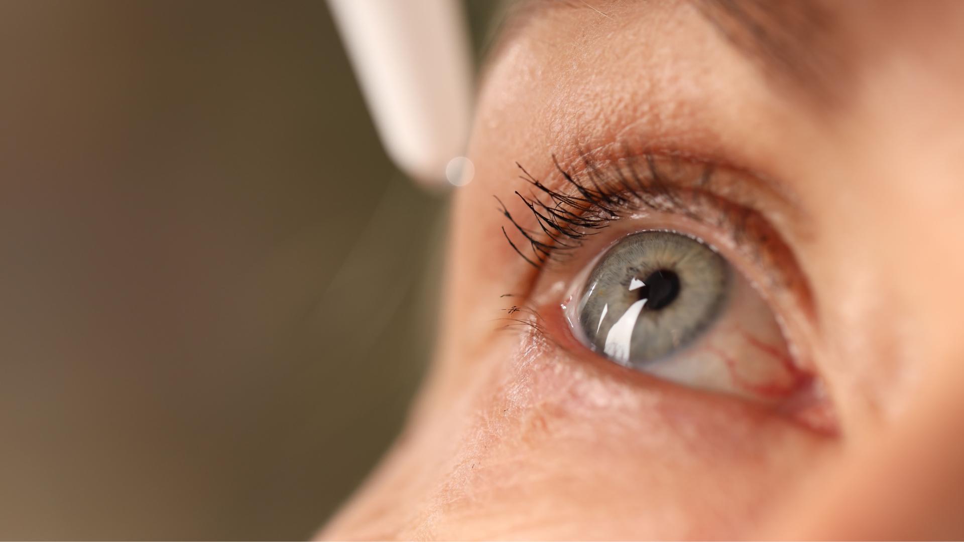 Síntomas y tratamientos de la uveítis